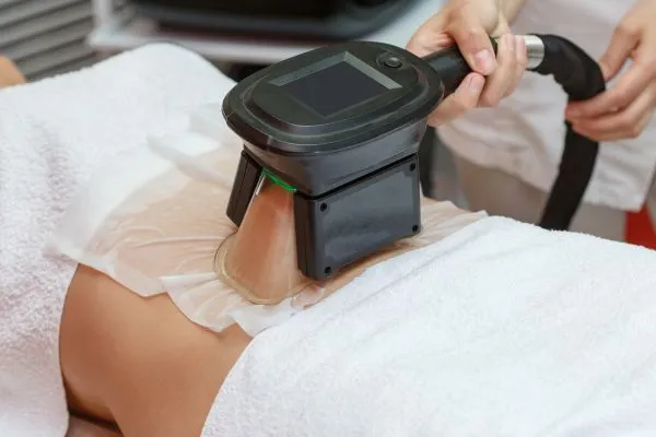 Image of person having fat freezing treatment to help weight gain Sighthill