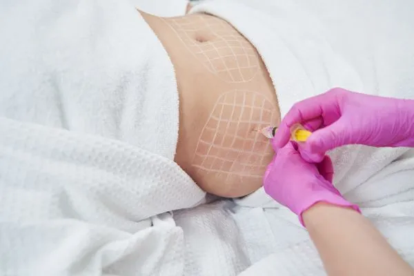 image of fat dissolving injections on love handles to help combat weight gain Sighthill