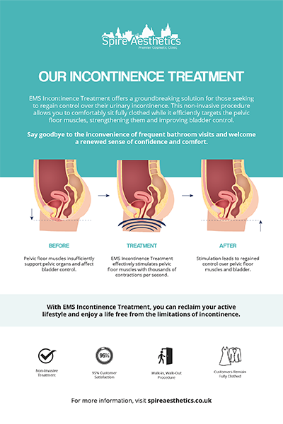 image to show how EMS treatment works for female urinary incontinence Sighthill