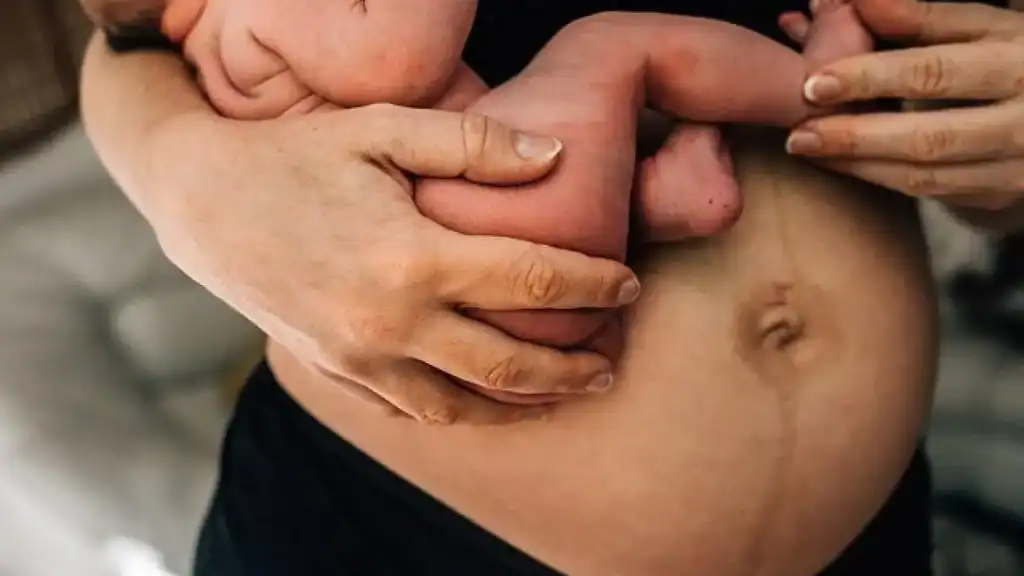 Why Is My Stomach Still Big After Pregnancy Sighthill?